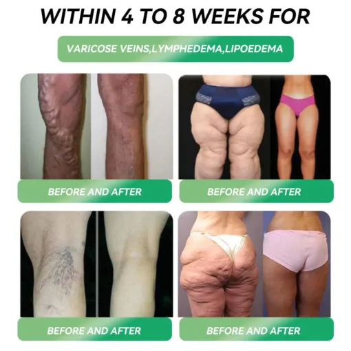 𝐏𝐞𝐚𝐤𝐚® 𝐆𝐋𝐏-𝟏 𝐎𝐫𝐚𝐥 𝐅𝐨𝐫𝐦𝐮𝐥𝐚 | 𝐒𝐮𝐩𝐩𝐨𝐫𝐭𝐬 𝐖𝐞𝐢𝐠𝐡𝐭 𝐋𝐨𝐬𝐬, 𝐓𝐲𝐩𝐞 𝟐 𝐃𝐢𝐚𝐛𝐞𝐭𝐞𝐬, 𝐇𝐞𝐚𝐫𝐭 𝐇𝐞𝐚𝐥𝐭𝐡 & 𝐉𝐨𝐢𝐧𝐭 𝐏𝐚𝐢𝐧 – 𝐑𝐞𝐬𝐮𝐥𝐭𝐬 𝐢𝐧 𝐉𝐮𝐬𝐭 𝟕 𝐃𝐚𝐲𝐬